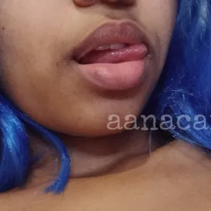 Hot Aninha 🔥