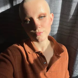 Bald, bold and bothered