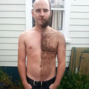 Hairy Navel