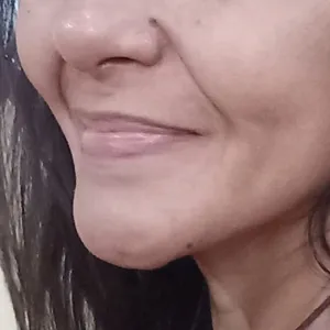 Todaela