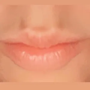 Melody